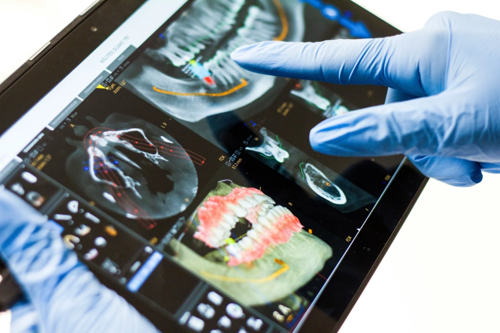 Glänzend blaue Schutzhandschuhe einer Patientin oder eines Chirurgen zeigen auf einem Tablet digitale 3D-DVT-Aufnahmen zur Implantatplanung; LIV dental studio Deisenhofen setzt millimetergenaue, digitale Planung ein.